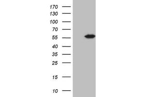 Western Blotting (WB) image for anti-4-Aminobutyrate Aminotransferase (ABAT) (AA 29-323) antibody (ABIN2715603) (ABAT anticorps  (AA 29-323))