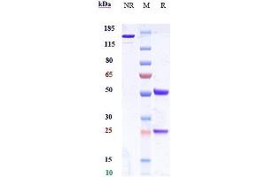 Anti-ICOS / CD278 Reference Antibody (alomfilimab) on SDS-PAGE under reducing (R) condition.