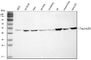 Western blot analysis of Hsp47/SERPINH1 using anti-Hsp47/SERPINH1 antibody (ABIN3043331). (SERPINH1 anticorps  (AA 247-418))