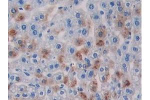 Detection of RIPK3 in Mouse Liver Tissue using Polyclonal Antibody to Receptor Interacting Serine Threonine Kinase 3 (RIPK3)