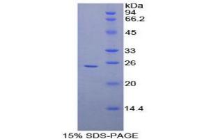 SDS-PAGE analysis of Human Coronin 1A Protein. (Coronin 1a Protéine)
