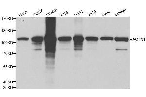 Western blot analysis of extracts of various cell lines, using ACTN1 antibody. (ACTN1 anticorps  (AA 1-330))