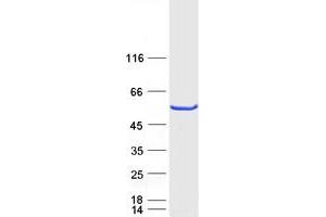 Validation with Western Blot