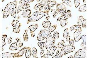 IHC analysis of Cyclophilin E/PPIE using anti-Cyclophilin E/PPIE antibody (ABIN7599242). (PPIE anticorps  (AA 1-301))