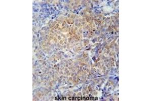 Immunohistochemistry (IHC) image for anti-Serpin Family H Member 1 (SERPINH1) antibody (ABIN2910986) (SERPINH1 anticorps)