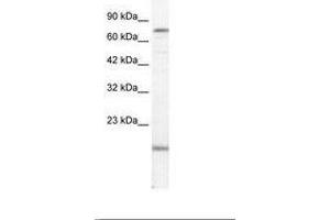 Image no. 1 for anti-PiggyBac Transposable Element Derived 3 (PGBD3) (AA 52-101) antibody (ABIN202794) (PGBD3 anticorps  (AA 52-101))