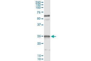 Immunoprecipitation of HSPB1 transfected lysate using anti-HSPB1 monoclonal antibody and Protein A Magnetic Bead , and immunoblotted with HSPB1 MaxPab rabbit polyclonal antibody.