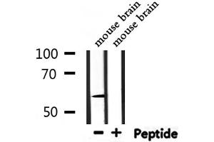 Western blot analysis of extracts from mouse brain, using UGT1A9  Antibody.
