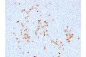 Immunohistochemical staining (Formalin-fixed paraffin-embedded sections) of human tonsil with IgG (Heavy Chain) polyclonal antibody . (Lapin anti-Humain Immunoglobulin Heavy Constant gamma 1 (G1m Marker) (IGHG1) (Heavy Chain) Anticorps)