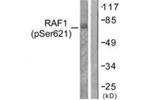 Western blot analysis of extracts from HeLa cells treated with UV 5', using C-RAF (Phospho-Ser621) Antibody. (RAF1 anticorps  (pTyr621))