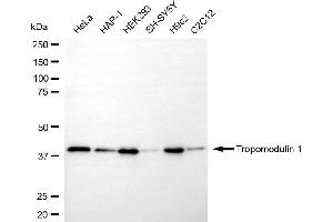 anti-Tropomodulin 1 (TMOD1) antibody