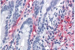 Human Small Intestine: Formalin-Fixed, Paraffin-Embedded (FFPE) (MYOC anticorps  (AA 36-135))