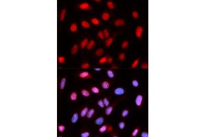 Immunofluorescence analysis of U2OS cells using RFC4 antibody. (RFC4 anticorps)