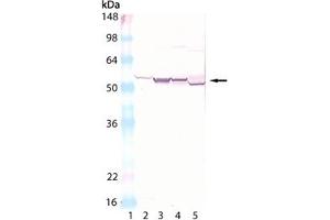 Western blot analysis of Cytochrome P450: Lane 1: MWM, Lane 2: Human Liver microsomes, Lane 3: Rat Liver Microsomes, Lane 4: Mouse Liver Microsomes, Lane 5: Rabbit Liver Microsomes. (Cytochrome P450 anticorps)