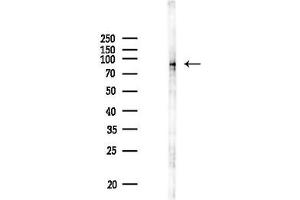 anti-Chromosome 1 Open Reading Frame 170 (C1ORF170) antibody