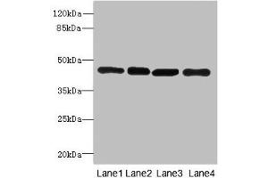 Western blot All lanes: PAICSantibody at 3. (PAICS anticorps  (AA 176-425))