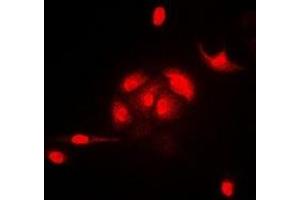 Immunofluorescent analysis of HEMK2 staining in A549 cells. (N6AMT1 anticorps)