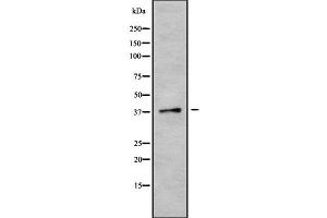 Western blot analysis of CGRRF1 using K562 whole cell lysates (CGR19 anticorps  (Internal Region))