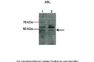 Lanes:  Lane1: 10 ug COS-7 cell lysate Lane2: 10 ug bovine aortic endothelial cell lysate Primary Antibody Dilution:  1:1000 Secondary Antibody:  Anti-rabbit HRP Secondary Antibody Dilution:  1:2000 Gene Name:  Asl Submitted by:  Shawn Elms. (ASL anticorps  (C-Term))
