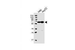 Western Blot at 1:1000 dilution Lane 1: Hela whole cell lysate Lane 2: HepG2 whole cell lysate Lysates/proteins at 20 ug per lane. (UTP6 anticorps  (N-Term))