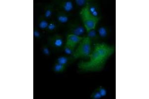 Image no. 3 for anti-Tripartite Motif Containing 38 (TRIM38) (AA 1-265) antibody (ABIN1490682) (TRIM38 anticorps  (AA 1-265))