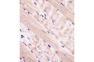 (ABIN652609 and ABIN2842407) staining RAB7 in human skeletal muscle tissue sections by Immunohistochemistry (IHC-P - paraformaldehyde-fixed, paraffin-embedded sections). (RAB7A anticorps  (C-Term))