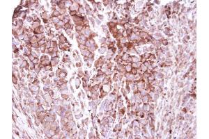 IHC-P Image Immunohistochemical analysis of paraffin-embedded H661 xenograft, using ZO-1, antibody at 1:250 dilution. (TJP1 anticorps  (N-Term))