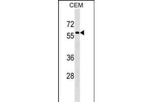 MSL3 Antibody (N-term) (ABIN1539253 and ABIN2849308) western blot analysis in CEM cell line lysates (35 μg/lane). (MSL3 anticorps  (N-Term))
