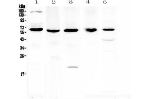 Western blot analysis of TRAF3 using anti-TRAF3 antibody . (TRAF3 anticorps  (AA 298-551))