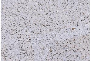 IHC analysis of HP1 alpha/CBX5 using anti-HP1 alpha/CBX5 antibody (ABIN7599057). (CBX5 anticorps  (AA 1-191))