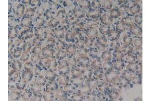 Detection of TLN1 in Rat Stomach Tissue using Polyclonal Antibody to Talin 1 (TLN1)