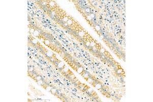 Immunohistochemistry analysis of paraffin embedded rat colon using PMCA1 (ABIN7073155) at dilution of 1: 1000