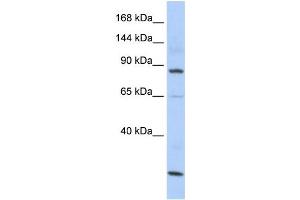 Western Blotting (WB) image for anti-MutS Homolog 5 (MSH5) antibody (ABIN2458577) (MSH5 anticorps)