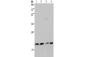 Gel: 10 % SDS-PAGE, Lysate: 40 μg, Lane 1-4: Jurkat cells, K562 cells, PC3 cells, A549 cells, Primary antibody: ABIN7130206(MCTS1 Antibody) at dilution 1/200, Secondary antibody: Goat anti rabbit IgG at 1/8000 dilution, Exposure time: 3 minutes (MCTS1 anticorps)