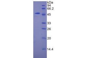 SDS-PAGE analysis of Mouse CPT1A Protein.