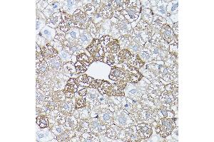 Immunohistochemistry of paraffin-embedded rat liver using [KO Validated] Glutamine Synthetase (Glutamine Synthetase (GLUL)) Rabbit pAb (ABIN6130425, ABIN6141161, ABIN6141162 and ABIN7101772) at dilution of 1:150 (40x lens). (GLUL anticorps  (AA 1-373))