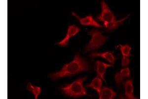 ABIN6276268 staining HuvEc by IF/ICC.