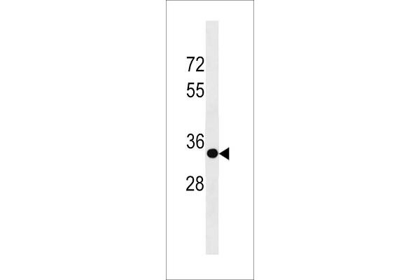 SPRY3 antibody  (C-Term)