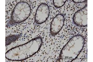 Image no. 3 for anti-High-Mobility Group 20A (HMG20A) (AA 153-263) antibody (ABIN599514) (HMG20A anticorps  (AA 153-263))