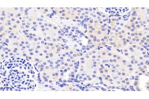 Detection of LAMa3 in Human Kidney Tissue using Polyclonal Antibody to Laminin Alpha 3 (LAMa3) (LAMA3 anticorps  (AA 47-296))