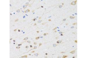 Immunohistochemistry of paraffin-embedded Rat brain using CHRM5 Polyclonal Antibody at dilution of 1:100 (40x lens). (CHRM5 anticorps)