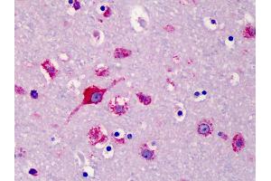 Anti-SLC35D1 antibody IHC of human brain, cortex. (SLC35D1 anticorps  (N-Term))