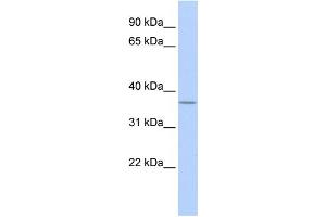WB Suggested Anti-MTHFD2 Antibody Titration:  0. (MTHFD2 anticorps  (N-Term))