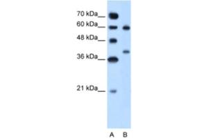 Western Blotting (WB) image for anti-Arginase, Liver (ARG1) antibody (ABIN2462876) (Liver Arginase anticorps)