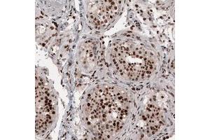 Immunohistochemical staining (Formalin-fixed paraffin-embedded sections) of human testis shows strong nuclear positivity in cells in seminiferous tubules. (METTL14 anticorps)