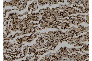 ABIN6273321 at 1/100 staining Human lung tissue by IHC-P.