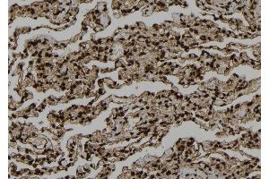 ABIN6273321 at 1/100 staining Human lung tissue by IHC-P. (SMYD3 anticorps  (N-Term))