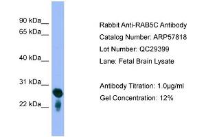 WB Suggested Anti-RAB5C  Antibody Titration: 0. (Rab5c anticorps  (Middle Region))