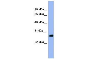 WB Suggested Anti-RAB5A Antibody Titration: 0. (RAB5 anticorps  (Middle Region))