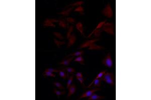 Immunofluorescence analysis of U2OS cells using TYK2 Rabbit pAb (ABIN3022987, ABIN3022988, ABIN3022989 and ABIN6219333) at dilution of 1:150 (40x lens).